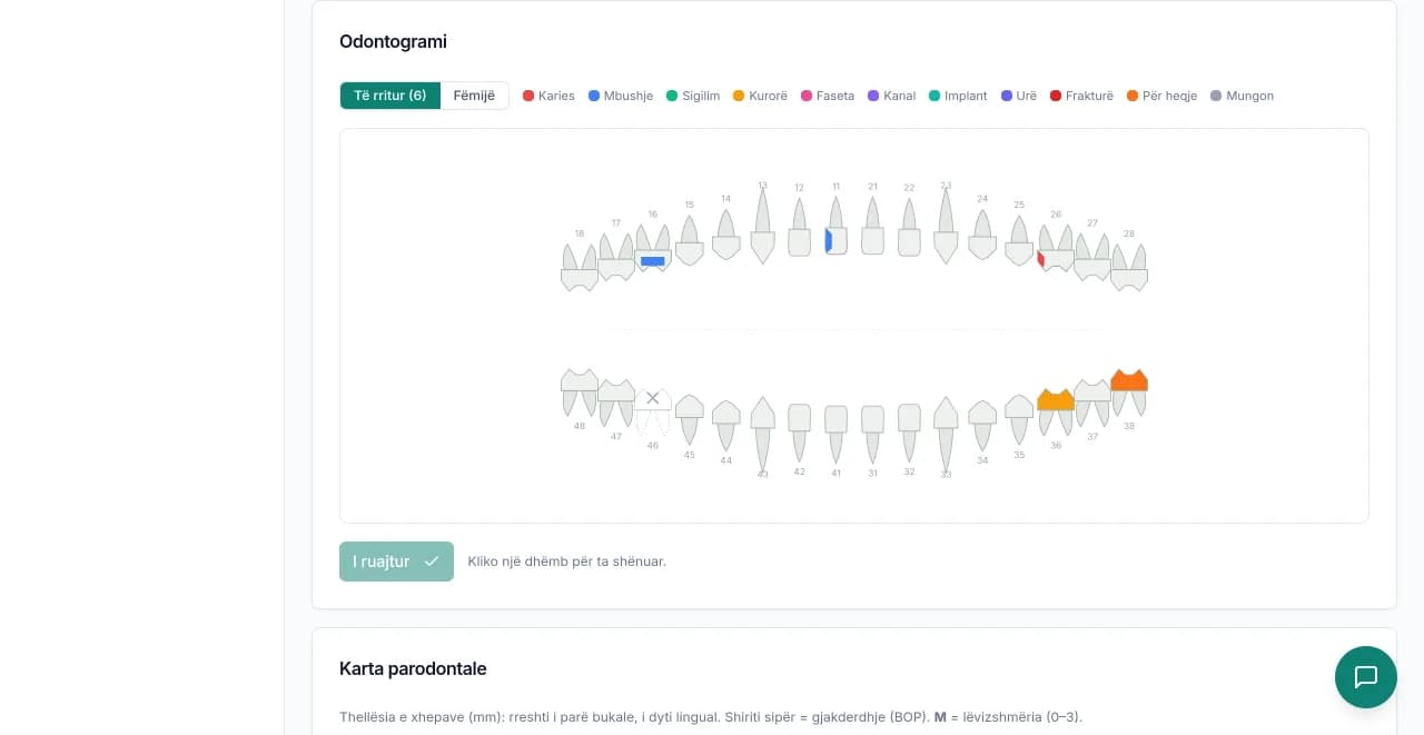Odontogram vizual demo me dhëmbë të shënuar dhe legjendë statusesh